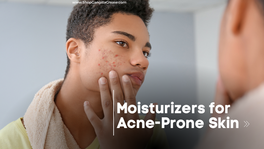 Moisturizer for Acne Prone Skin