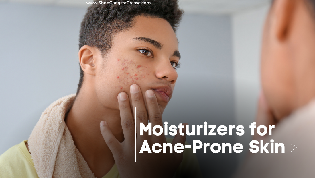 Moisturizer for Acne Prone Skin